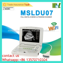 MSLDU07 Дешевые и высокоэффективные Latop ультразвуковой машины Допплер Ультразвуковая машина цена